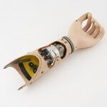 Prosthetic Hand Powered by Carbon Dioxide 2 © Science Museum Group
